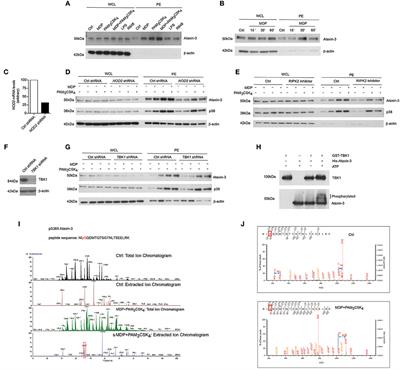 Ataxin-3 Links NOD2 and TLR2 Mediated Innate Immune Sensing and Metabolism in Myeloid Cells